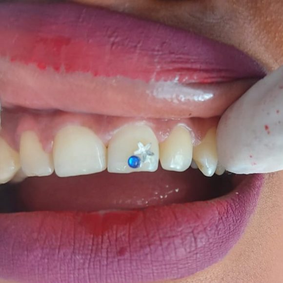 Tooth Jewellery