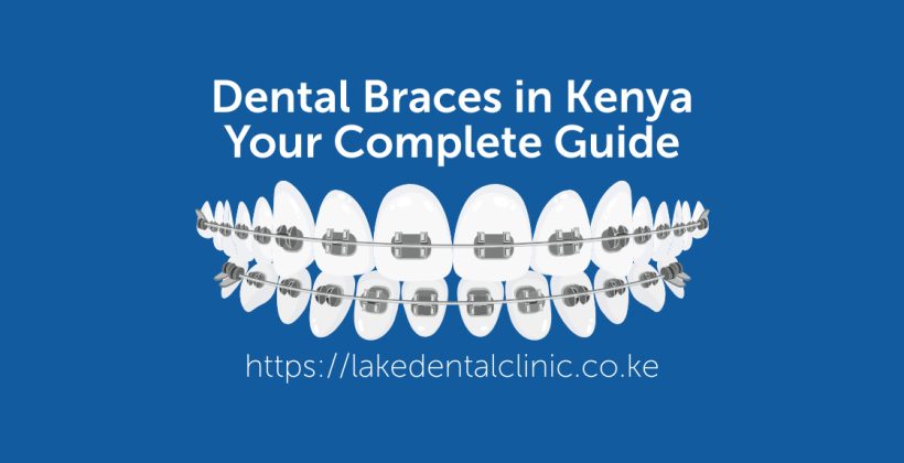 Dental braces in Kenya; your complete guide