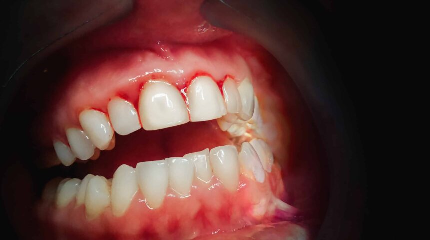 5 warning signs your gums are crying for help (and what to do about it)